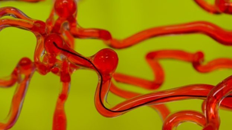 麻省理工開發磁控線性機器人，能在腦血管中自由穿梭